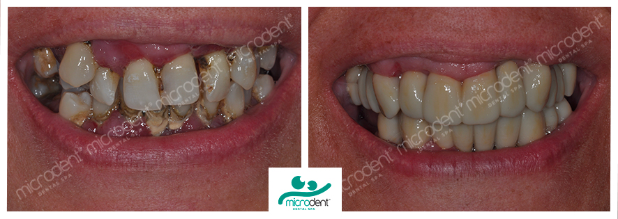 Case 1 Clinical Photos Comparison