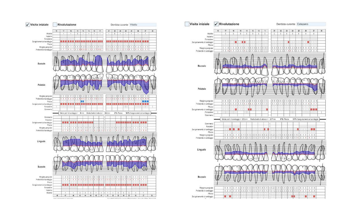 Case 1 Periodontal Chart Comparison